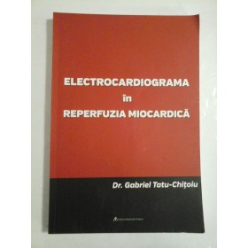 ELECTROCARDIOGRAMA in REPERFUZIA  MIOCARDICA  -  Gabriel Tatu - Chitoiu 